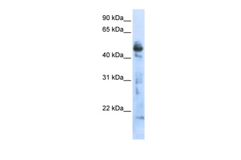 OXSM Antibody