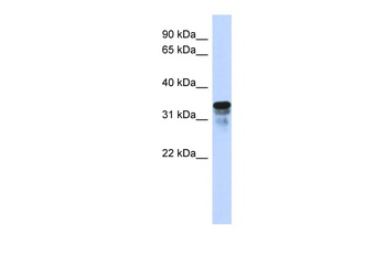 FAM82B Antibody