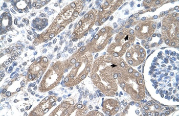 TDO2 Antibody