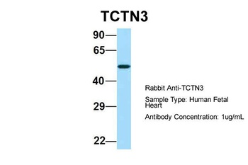 TCTN3 Antibody