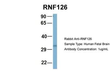 RNF126 Antibody