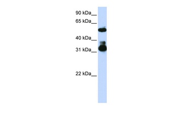 FBXW2 Antibody