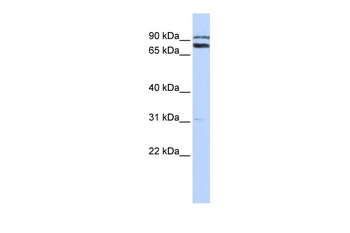 TRIM67 Antibody