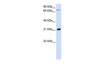 UPP1 Antibody