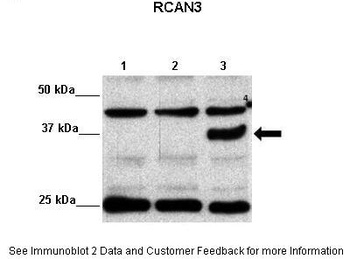 RCAN3 Antibody