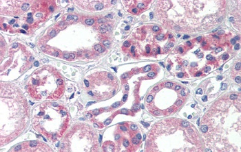 TRIM68 Antibody
