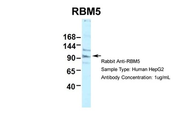 RBM5 Antibody