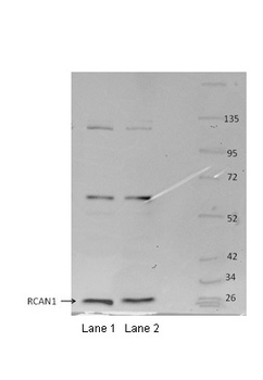 RCAN1 Antibody