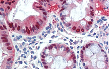 SCML1 Antibody