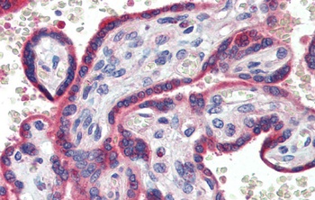 ZNF165 Antibody