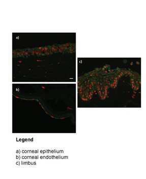 ZNF133 Antibody