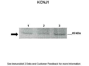 KCNJ1 Antibody