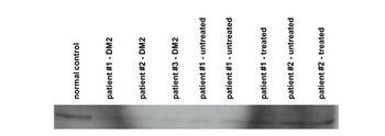 CNBP Antibody