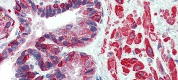 KIF13B Antibody