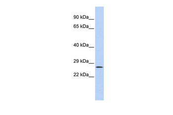 GATAD1 Antibody