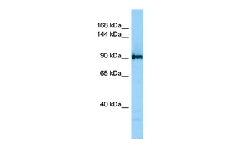 KDM4C Antibody