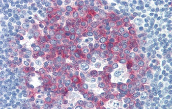 NCOA3 Antibody