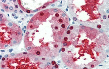 GATA3 Antibody
