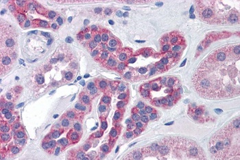 PIKE Antibody