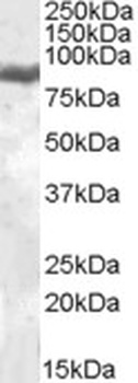 IDS Antibody