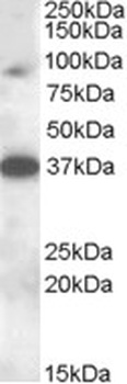 HOXD10 Antibody