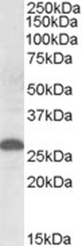 LASS1 Antibody