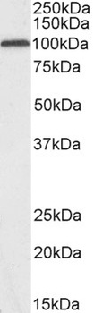 ZNF423 Antibody