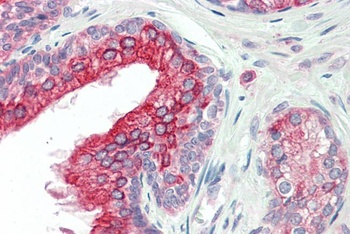 Tankyrase 2 Antibody