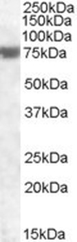 TRC8 Antibody