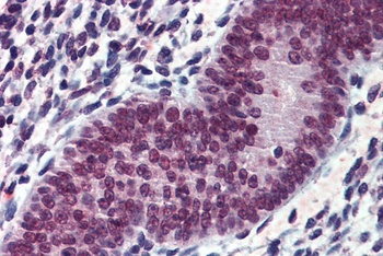 EWS Antibody