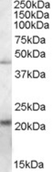 RSPH1 Antibody