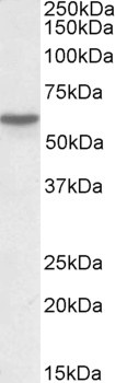 Tribbles Homolog 1 Antibody