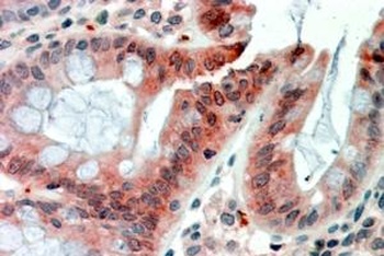 TRABID Antibody