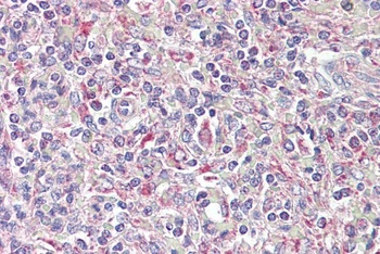 PGLYRP1 Antibody