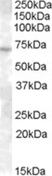 ABCC11 Antibody