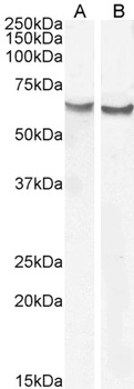 Frizzled 2 Antibody
