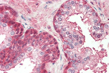 SH2D4A Antibody