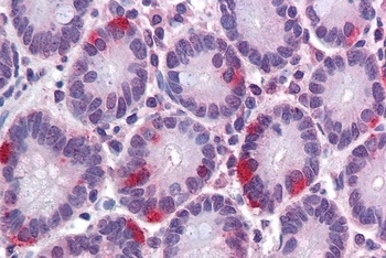 SAR1 Antibody
