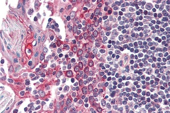 Urocortin 3 Antibody