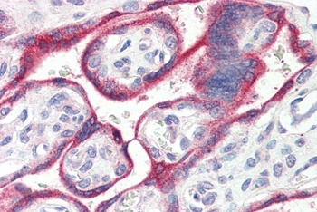 MARCH6 Antibody