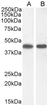 Argininosuccinate Synthetase 1 Antibody