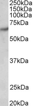 ZNF217 Antibody