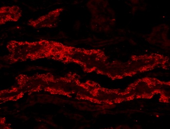 ZDHHC8 Antibody