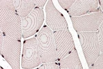 ZASP Antibody