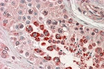 XAGE1 Antibody