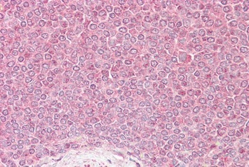 VPS45 Antibody