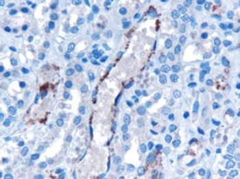 VPS25 Antibody