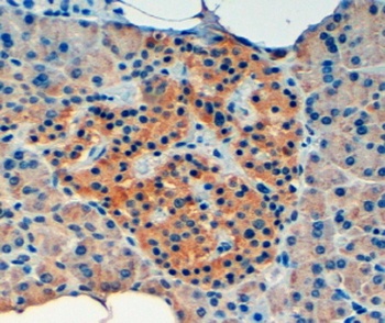 VPS11 Antibody