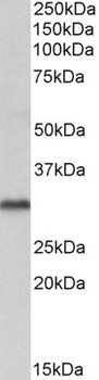 VDAC2 Antibody