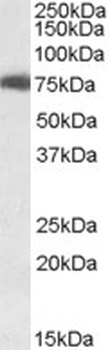 USH1C Antibody